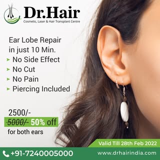 Ear Lobe Repair in Just 10 Min. 

Call us to know more about the treatment. 
Offer valid till 28 Feb