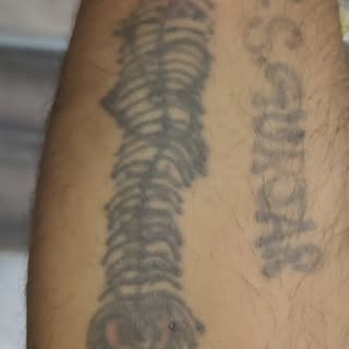 Laser Tattoo Removal

#lasertreatment #tattoo #lasertattooremoval #tattooremoval #laser #treatment #