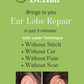 Ear Lobe Repair In Just 5 min. With laser Technique

Offer valid till 30 Nov 202

Call 7240005000 fo