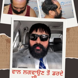 ਵਾਲ ਲਗਵਾਉਣ ਨੂੰ ਲੈ ਕੇ ਪਹਿਲਾਂ ਟੈਂਸ਼ਨ ਸੀ... ਅੱਜ ਰਿਜ਼ਲਟ ਦੇਖ ਕੇ ਮੁਸਕਾਨ ਆਪਣੇ ਆਪ ਆ ਜਾਂਦੀ ਹੈ. 😊

ਸਾਡੇ ਲੁਧਿਆ