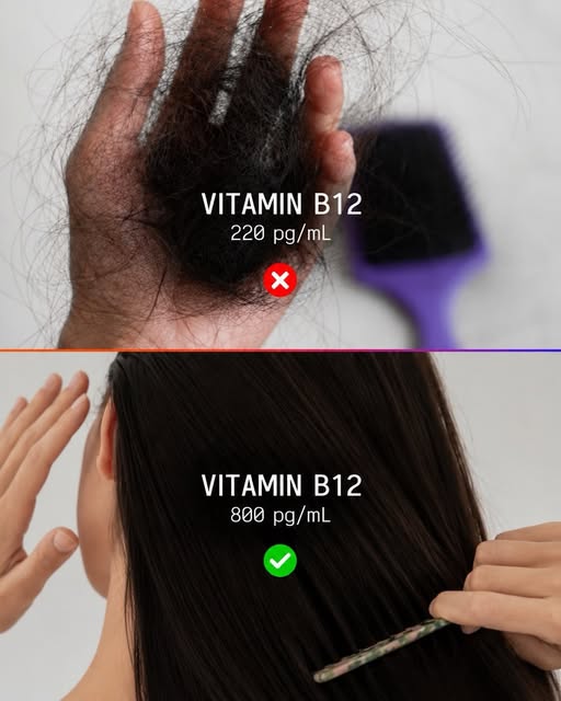Hair fall isn’t always just a hair problem. 🧑‍⚕️
Persistent hair shedding, thinning, or reduced den