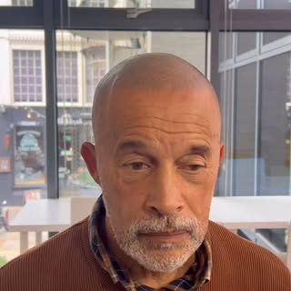 This is Scalp Micropigmentation, a cosmetic hair tattoo! 

Interested in the treatment? Send photos 