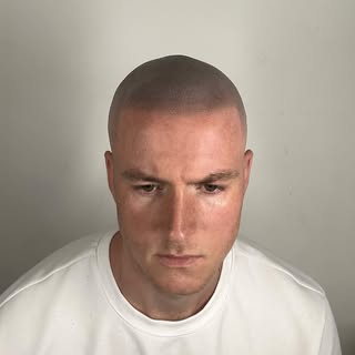 The freshly shaven effect 🪒 restore your hairline and confidence with Scalp Micropigmentation!

Int