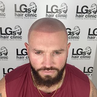Hairline back like it never left.. natural with a bit of definition 🔥

Interested in the treatment?