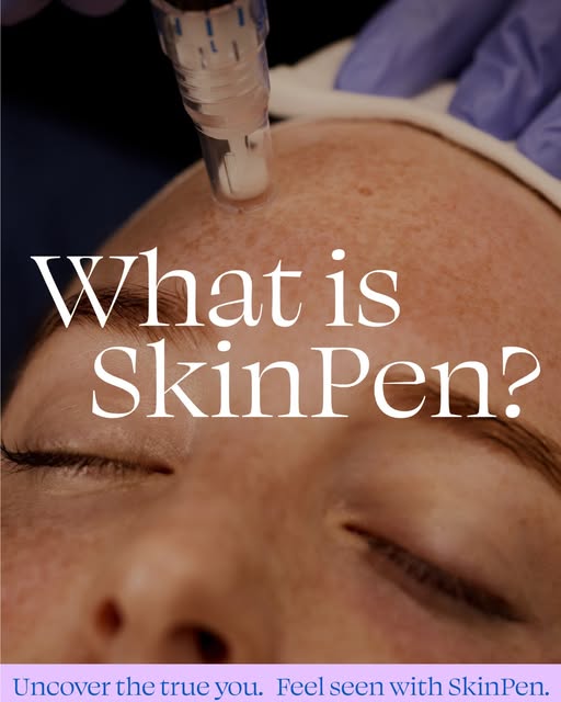 ✨ Thinking about Microneedling? If smoother, firmer, more refreshed-looking skin is on your list, Sk