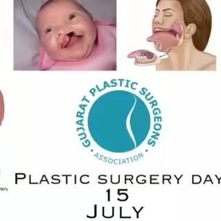 HAPPY PLASTIC SURGERY DAY 
Because of name people at times are confused - what exactly the plastic s