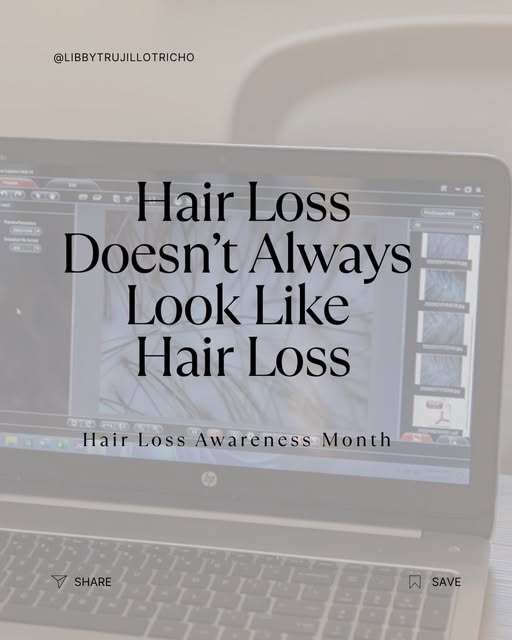 Hair loss doesn’t always look the way you expect.

For Hair Loss Awareness Month, a reminder that su
