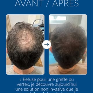 La confiance est au cœur de chaque résultat. Merci de me l’avoir accordée. #temoignage #avantapres #