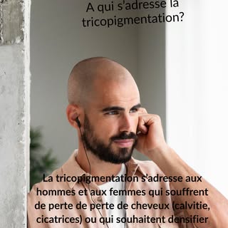 C’est une méthode non invasive, sans chirurgie, qui permet de recréer un effet crâne rasé ultra natu