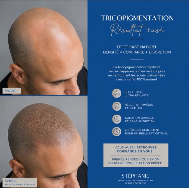 #cheveuxrasés #tondeuse #pertedecheveux #tatouagecheveux #micropigmentation
