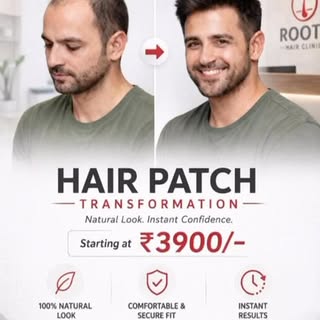 •	Bald → Bold 😎 Transform your look instantly!