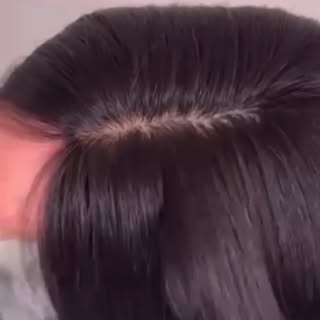 #trichologist #hairwigs #wigs #wigs for chemo patients #alopeciawigs