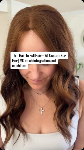 Thin hair to full hair all custom for her.

No two systems are the same because no two hairlines are