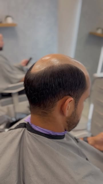 Diferentes estilos. Diferentes texturas. Diferentes personalidades.

En Procapilar, tú eliges cómo q