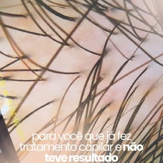 “Já fiz tratamento e não funcionou” 

Essa é uma das frases que mais escuto no consultório. Muitas p