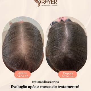Cada fio conta uma história. E essa é a prova de que um tratamento bem conduzido faz a diferença.

E