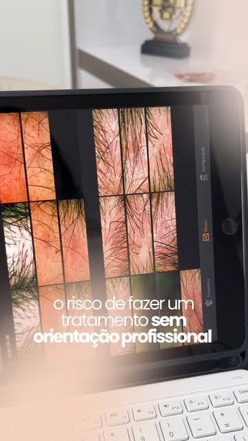 Tratar queda de cabelo sem acompanhamento profissional é contar com a sorte. O que funciona para out