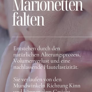 Ein Facelift kann Gesicht und Hals sichtbar straffen, Falten reduzieren und dir ein jüngeres, natürl