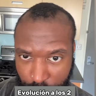 🔥 SU CARA LO DICE TODO… Y SOLO HAN PASADO 6 MESES.

A los 2 meses, ya empieza a ver que algo está p