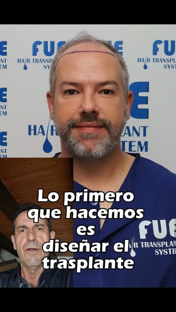 🚨 Si estás perdiendo pelo, este vídeo puede cambiar la decisión que tomes este año.
No estás viendo