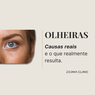 Olheiras não são todas iguais.
Pigmentares, vasculares ou estruturais — cada tipo tem uma causa dife