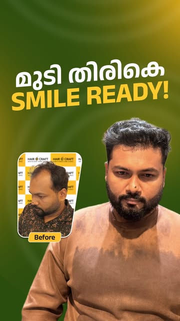 Three years of confidence regained — and a hair transformation that speaks for itself. ✨

Mr. Abhish