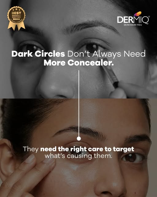 Dark circles aren’t always a sign that you need more concealer. ✨ The right care starts with underst