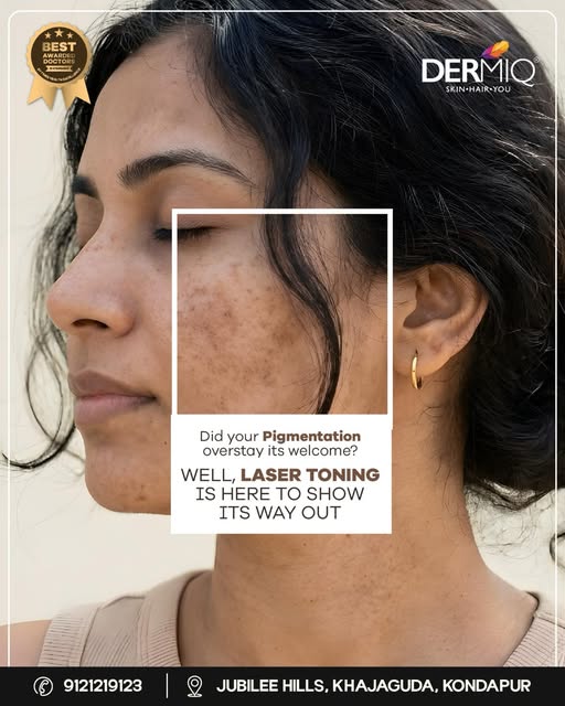 Pigmentation that overstayed its welcome deserves a way out. ✨
With advanced Laser Toning at Dermiq,
