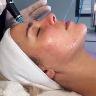 Because glowing skin isn’t luck — it’s HydraFacial! ✨

Book your HydraFacial at Dinaaz now!

( Dinaa