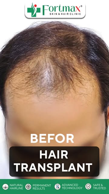 Good hair days can become your everyday. ✨Restore your hair. Refresh your look. Step forward with co