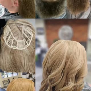 As we approach a new season, it’s a good reminder that change is possible. September is #Alopecia Aw