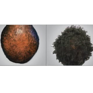 1,563 Graft Hair Transplant #hairtransplant #toronto #hairloss