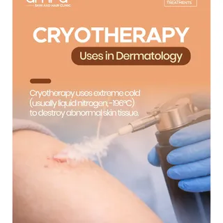 ❄️ Cryotherapy: Freeze Away Unwanted Skin Concerns! ✨

Cryotherapy is a safe and effective dermatolo