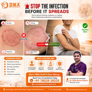 𝐃𝐨𝐧'𝐭 𝐥𝐞𝐭 𝐚 𝐟𝐮𝐧𝐠𝐚𝐥 𝐢𝐧𝐟𝐞𝐜𝐭𝐢𝐨𝐧 𝐬𝐩𝐫𝐞𝐚𝐝. 𝐀𝐜𝐭 𝐞𝐚𝐫𝐥𝐲!

Persistent itc
