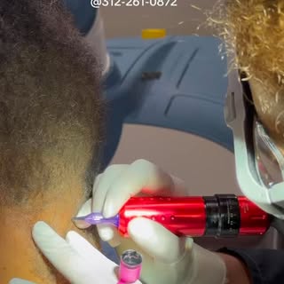 #hairloss #micropigmentation #viralvideos