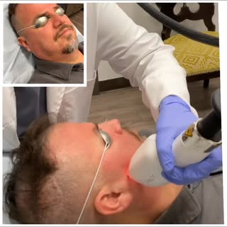 #dryateslifestylemed #foryou #skincare #facials @yateshairandmedspa