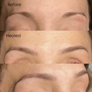 Can you spot the difference?

Sometimes less is more❤️-Before and After
#nanobrows #healedbrows #tor