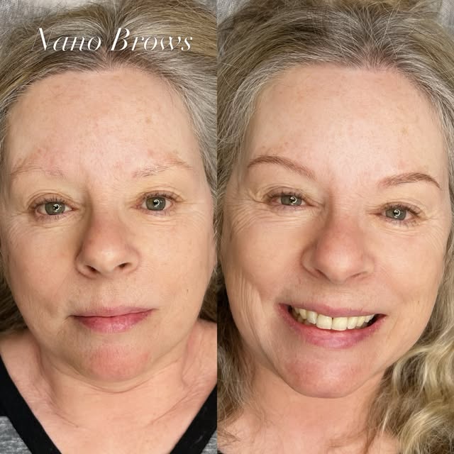 Healed Nano Strokes

#healedbrows #nanobrows #toronto #nanomachinehairstrokes #pmuartist b
