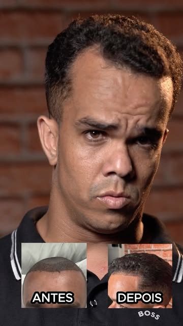 Ser anão nunca foi uma coisa que me incomodou. Agora, a calvície era diferente. Isso mexia com a min