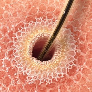 Peri-follicular scaling simply means a small ring of skin or scale forming around the opening of a h