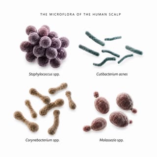 The scalp is not sterile. It supports a living community of bacteria and fungi, often referred to as