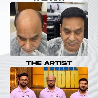 The Art of Transformation meets The Artists behind the magic. 💇‍♂️✨

From hair loss to a confident 
