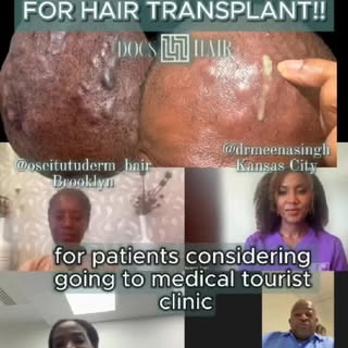@Docs4Hair brought hair transplant surgeons from 4 different time zones to discuss hair transplant t