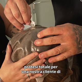 Una protesi capillare totale, completamente personalizzata. ✨

Ogni dettaglio viene studiato per ada