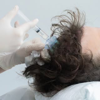 Transforma tu cabello con nuestros tratamientos capilares. No siempre es necesario pasar por quirófa