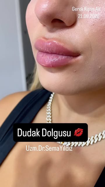 Estetik ve Kozmetik Uygulamalar
.
Sadece bilgilendirme amaçlıdır, tanı ve tedavi için mutlaka doktor