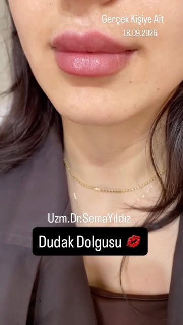 Estetik ve Kozmetik Uygulamalar
.
Sadece bilgilendirme amaçlıdır, tanı ve tedavi için mutlaka doktor