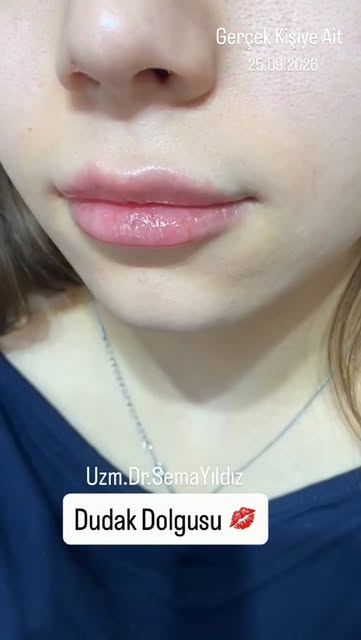Estetik ve Kozmetik Uygulamalar
.
Sadece bilgilendirme amaçlıdır, tanı ve tedavi için mutlaka doktor