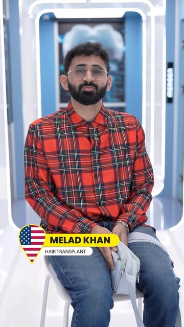 2nd Session hair transplant of Mr. Melad:

After achieving a very good result in the front and mid-s