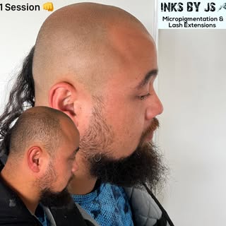 One dot at a time, no rush & be patient ❤️
-
-
-
💬Are you bald or have Thinning hair?
💬Do you want